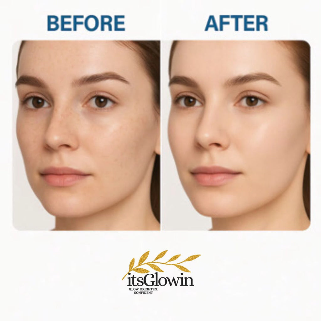 itsGlowin tranexamic acid cream for brightening and dark spots reduce freckles and blemishes