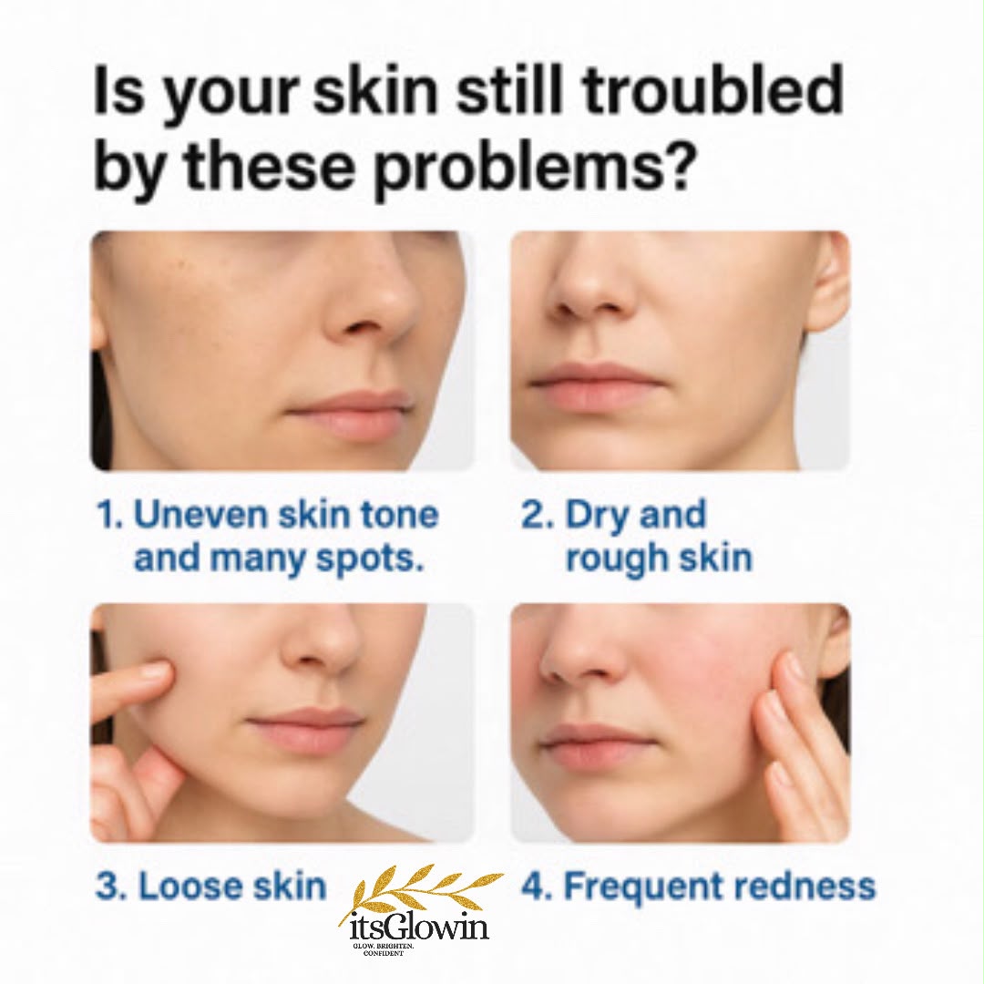 itsGlowin tranexamic acid cream for brightening and dark spots reduce freckles and blemishes